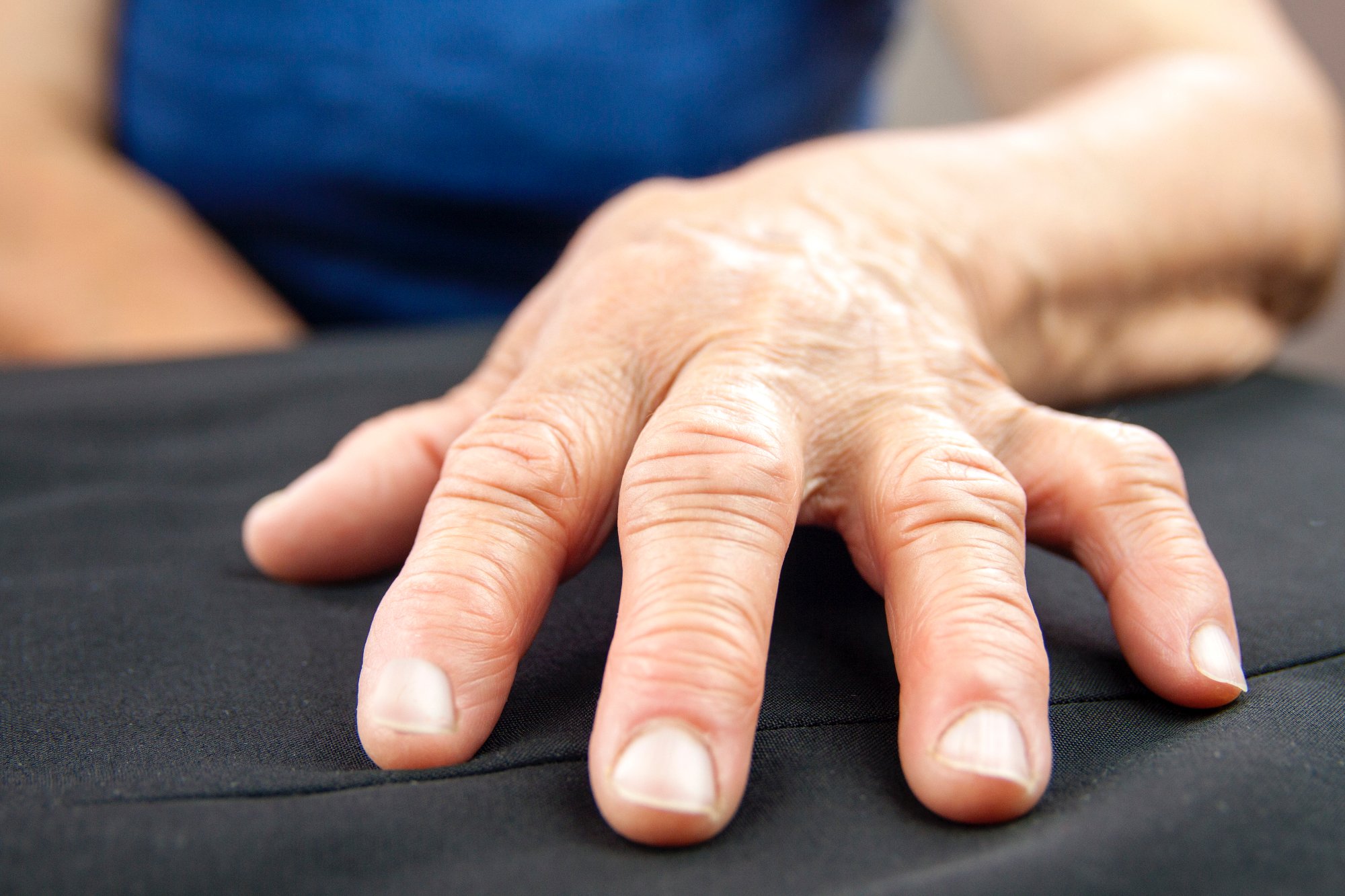 Revmatoidni artritis ti lahko pomaga pri izboljšanju načina življenja